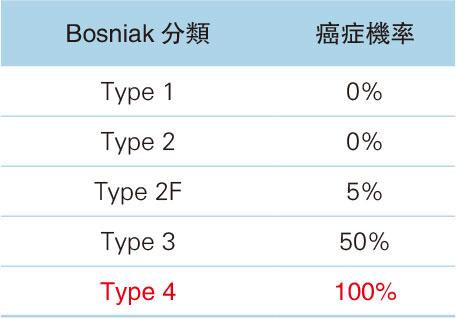 【有片】超聲波見腎囊腫 空心虛驚 實心多癌變