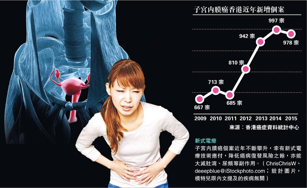 【女性健康】減副作用 復發率<3％ 手術＋近接電療 夾擊子宮內膜癌