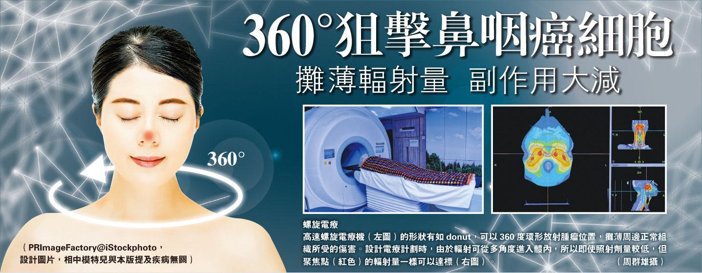 360°狙擊鼻咽癌細胞 攤薄輻射量 副作用大減