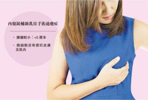 乳癌, 微創手術, 自我檢查,