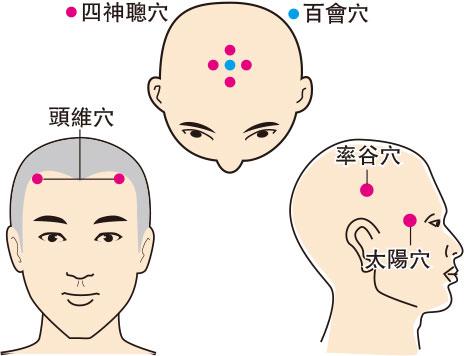 西醫脫髮治療 中醫調理肝腎 聯手搶救禿頭危機