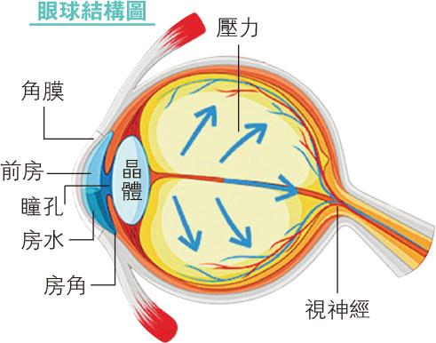 青光眼高危 點止銀髮族 熄燈玩手機、睡眠窒息症患者小心！