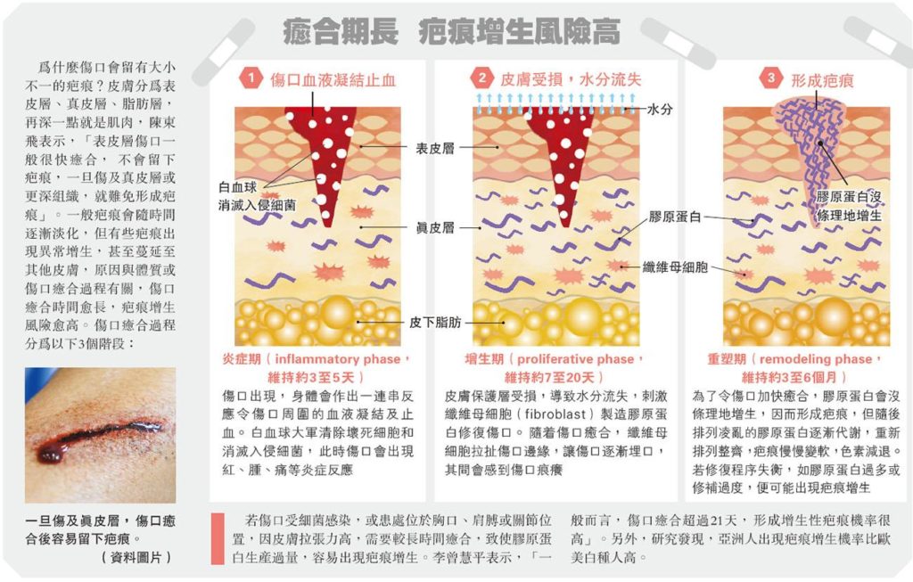 【去疤】傷口留痕 傷身更傷心 一張貼施壓保濕 撫平疤痕