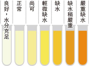 【腎石】少飲水易生腎石？尿液顏色愈深代表什麼？生活中如何保護腎臟健康？