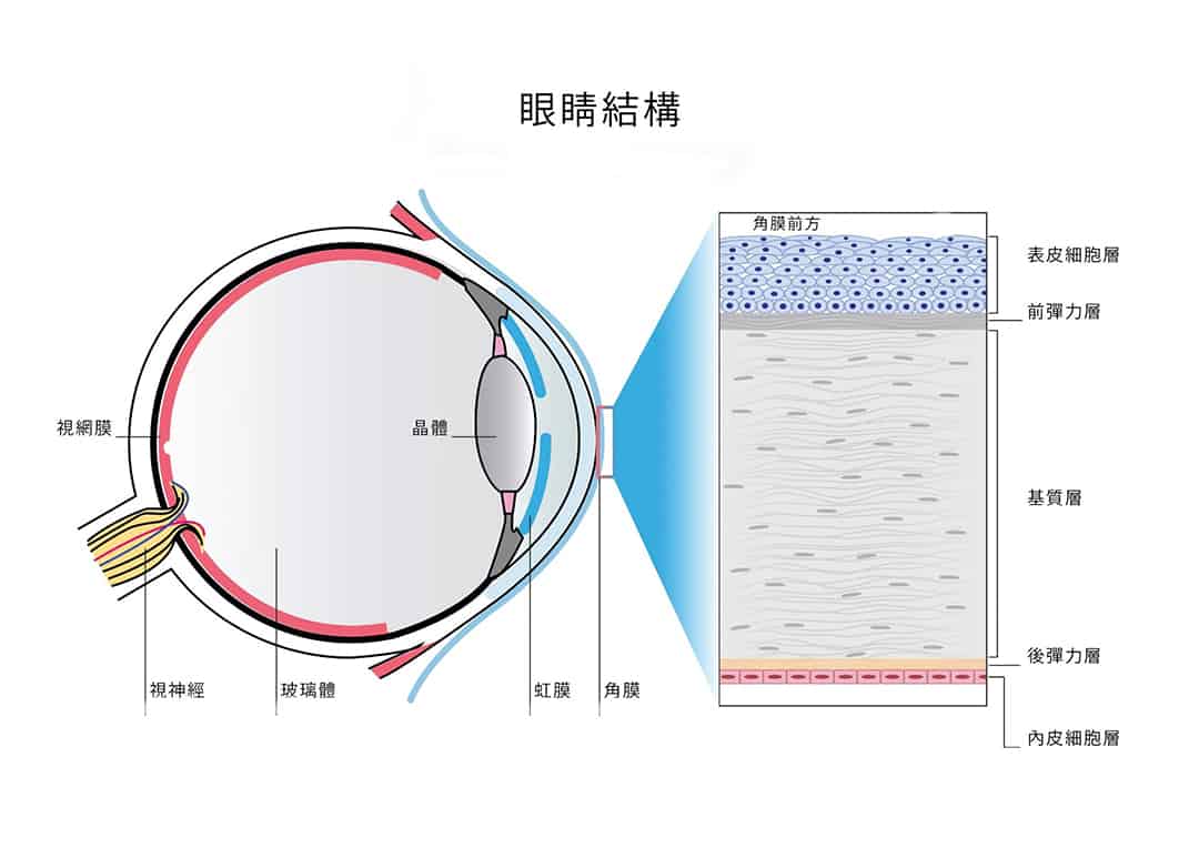 容易受傷的眼角膜 4大原因需角膜移植 手術演變、康復、風險不可不知