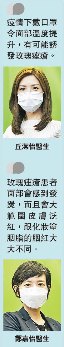 面上紅疹是玫瑰痤瘡定濕疹作怪 5個關於成因、治療、類固醇藥膏的問題