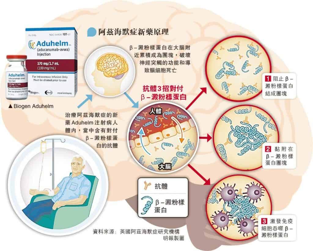 認知障礙症 阿茲海默症 Aduhelm 新藥