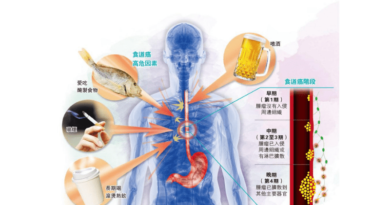 【食道癌】死亡率高 常見病徵吞嚥困難 注意5大高危因素：吸煙、嗜酒、長期胃酸倒流