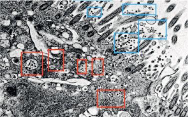 圖為顯微鏡下人類支氣管細胞感染Omicron，藍框是病毒附着微絨毛表面，紅框是病毒存在於細胞質中的膜結合囊泡。（港大醫學院facebook）