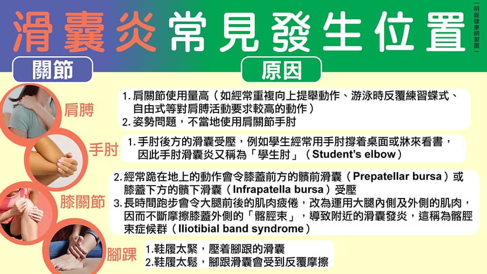 滑囊炎4個常見的關節位置包括：肩膊、手肘、膝關節和腳踝。