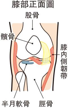 【膝痛】跑步姿勢不當3原因 肌肉不平衡?扁平足致膝關節內旋?正確跑姿話你知 (姿錯能改)