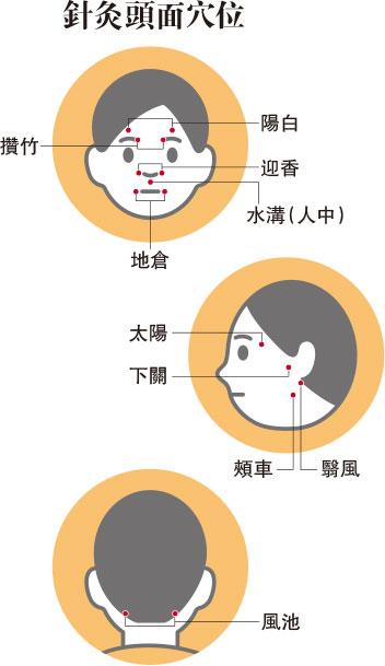 面癱是腦中風先兆？顏面神經受感染 嘴角歪、影響皺眉、喝水、味覺 了解成因與治療 