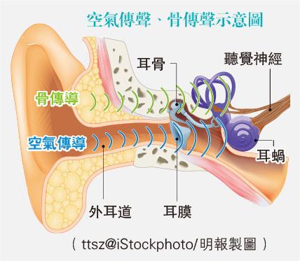聽力障礙有徵兆 降噪耳機非人人適應 或耳鳴頭暈耳壓失衡 護耳4個貼士