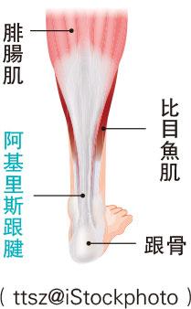 阿基里斯跟腱在哪？跟腱斷裂原因？術後護理、復康訓練４階段