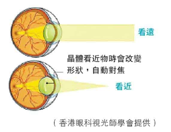 【視力】老花因眼球對焦調節力減弱？40歲有老花？96歲無老花？幾多度才要配眼鏡？ (明視理)