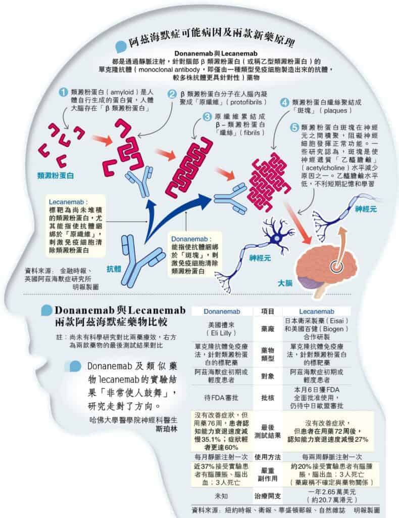 阿茲海默症新藥 初期患者認知退化減慢60% 副作用或引發腦腫脹、腦出血惹疑