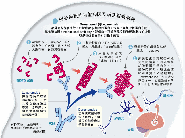 阿茲海默症新藥 初期患者認知退化減慢60% 副作用或引發腦腫脹、腦出血惹疑