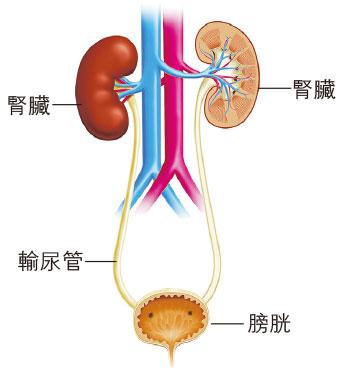 【尿路結石】腎臟、輸尿管或膀胱有結石 自然排出視乎大小、成分和位置 「過山車療法」是什麼？