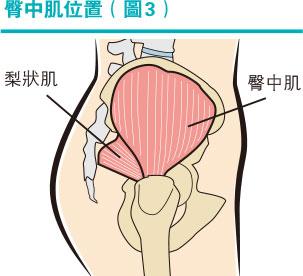 【痛症】跑步後下背、臀、大腿後側痛？測試和了解梨狀肌綜合徵4個症狀