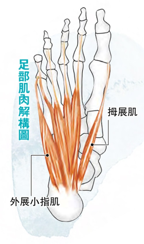 【腳痛】扁平足、足底筋膜炎 赤足鞋、赤腳行沙灘可改善?兩招增強腿肌肉、腳弓