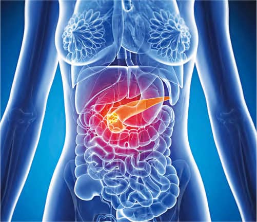 胰臟癌6個徵狀：上腹、背持續疼痛 皮膚痕癢 體重銳減