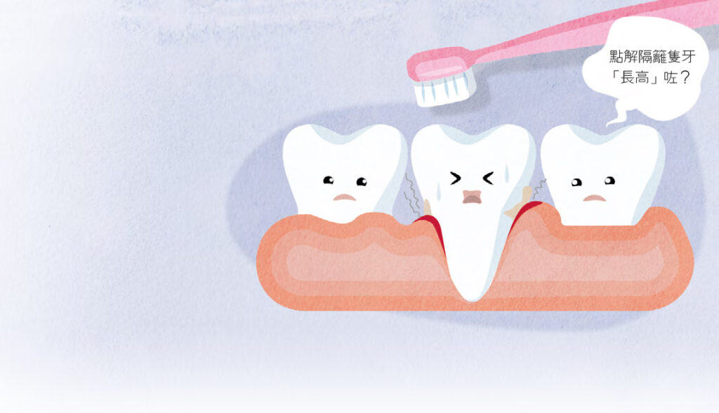 牙齦萎縮與牙周病、大力刷牙有關 牙膏漱口水預防有效嗎?