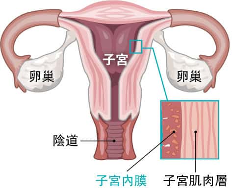 【子宮內膜癌】香港最常見女性癌症第4位 腫瘤可擴散至其他器官